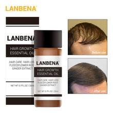 Load image into Gallery viewer, LANBENA Essence Of Rapid Growth Of Hair Care Essential Oil Liquid Treatment Prevention Of Hair Loss Products Men Women 20ML