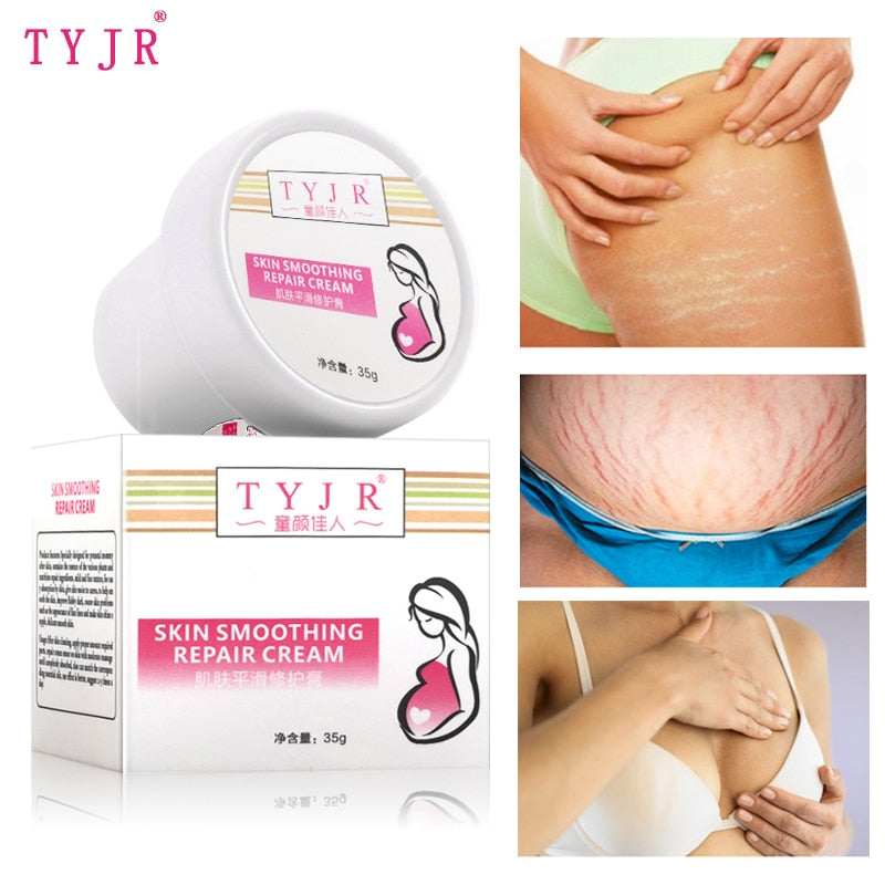 Effectively Repair Stretch Marks Removal Remover Plant Natural Heal Pregnancy Breast Hip Legs Stretch Mark Cream