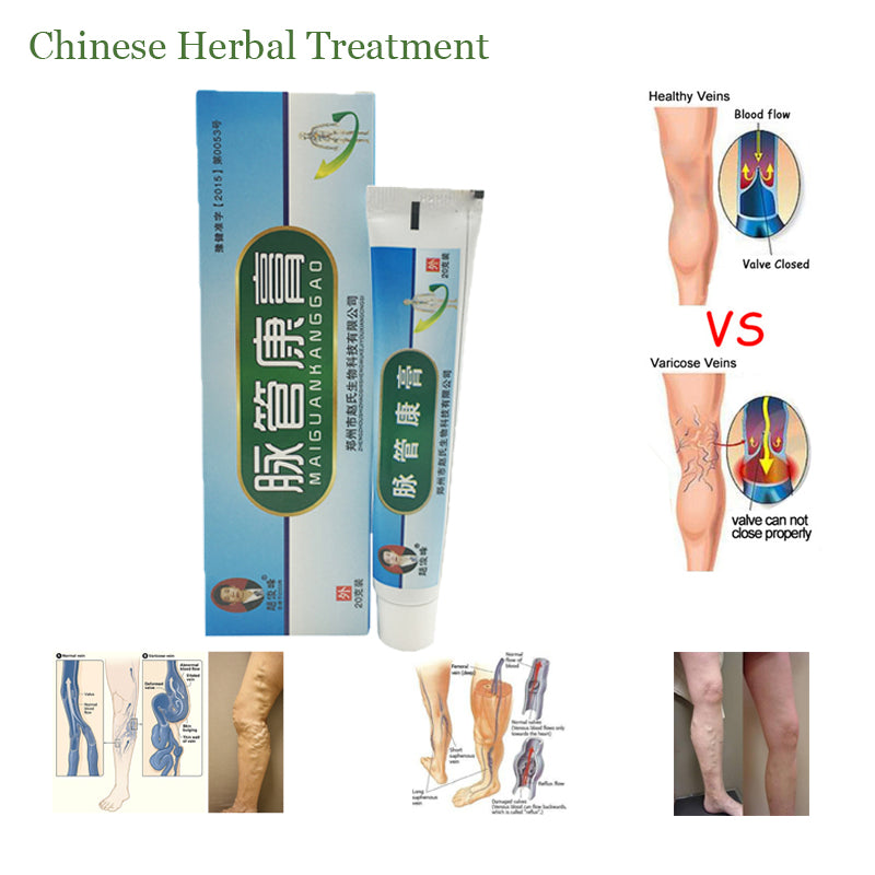 Newly 20g/box Chinese Natural Herbal Medicine Sophora Varicose Vein Ointment Massage for Treating Varicose Vascular